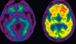 торможение в цнс